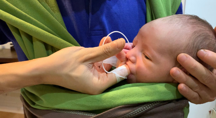 Un dispositif d'aide à l'allaitement (DAL) pas cher : la preuve par le bébé!
